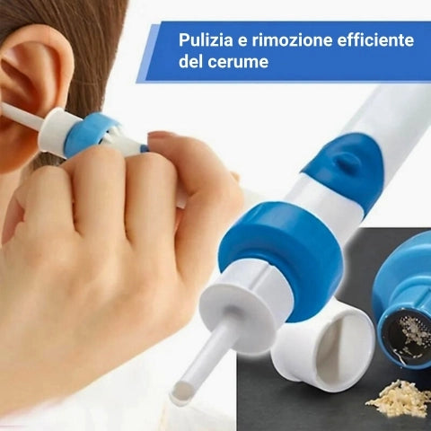 Aspiratore per cerume auricolare