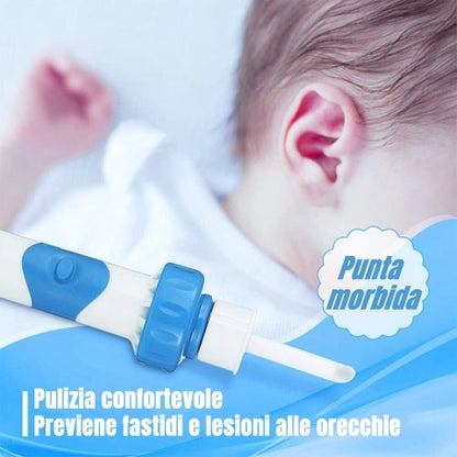 Aspiratore per cerume auricolare